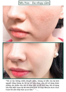 SỮA RỬA MẶT SOME BY MI AHA-BHA-PHA 30 DAYS MIRACLE