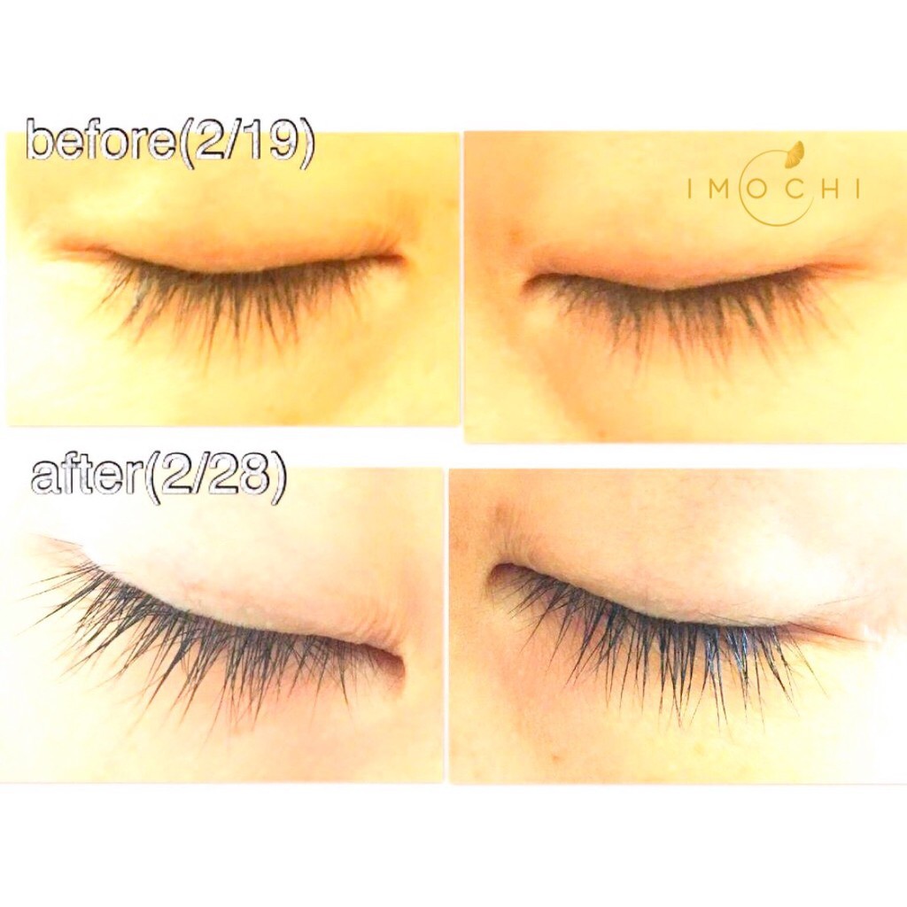 Serum Dưỡng Dài Mi DHC Eyelash Tonic 6.5ml Nhật Bản