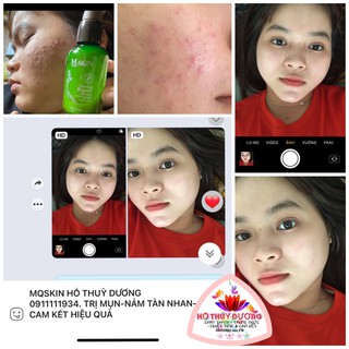 [CHÍNH HÃNG 100%-FAKE ĐỀN 1 TỶ] KEM FACE NHÂN SÂM MQSKIN