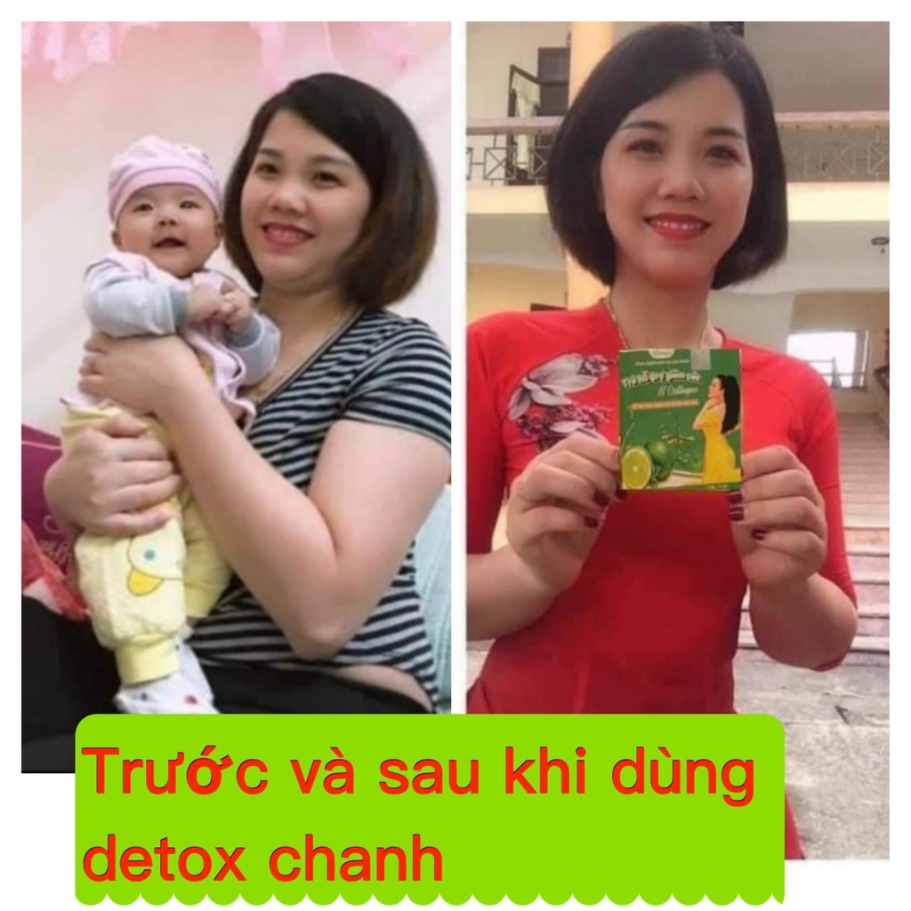 [TẶNG DETOX CẦN TÂY MẬT ONG 15 VIÊN] TRÀ CHANH HỖ TRỢ GIẢM CÂN N CCOLLAGEN HỘP 15 GÓI CHÍNH HÃNG