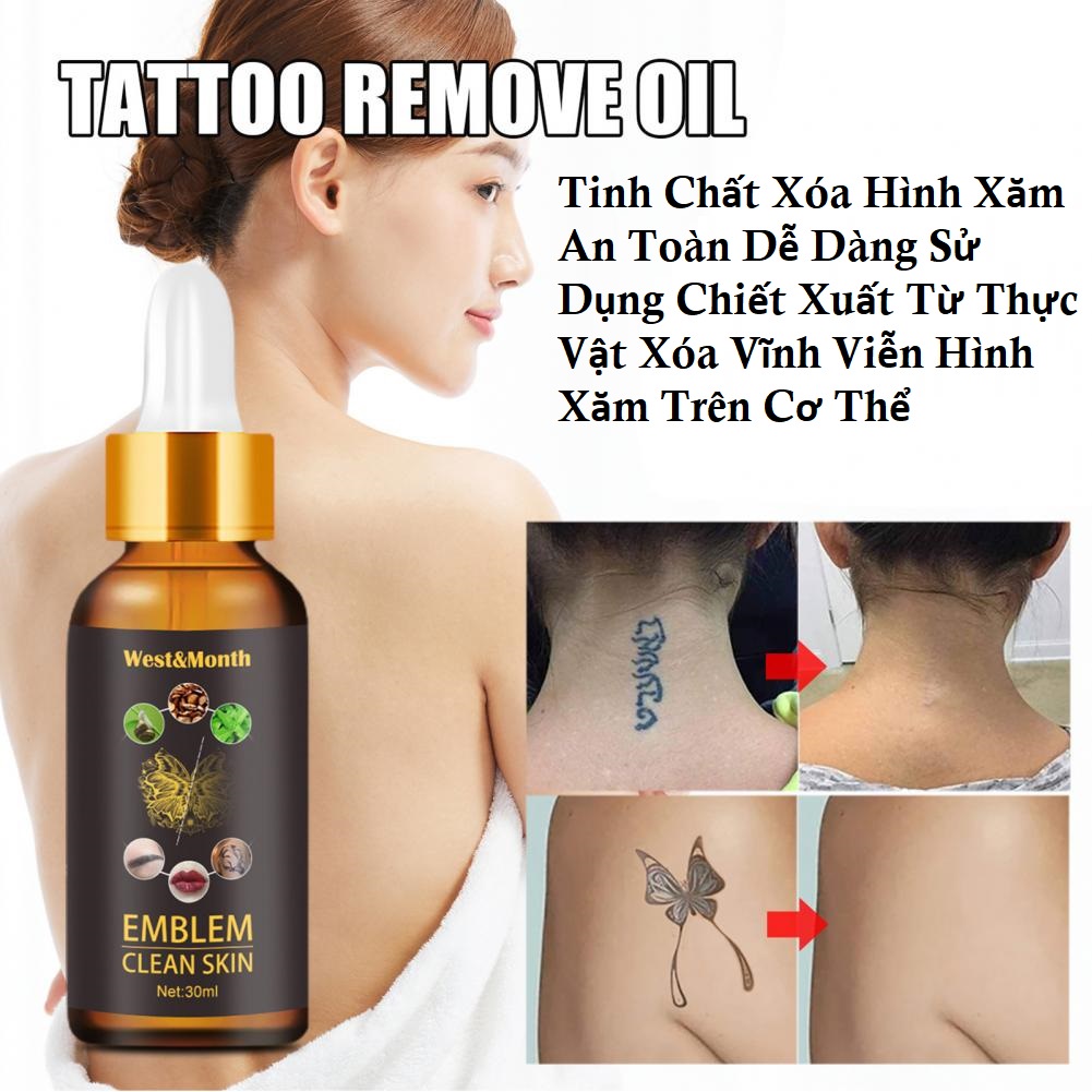 Tinh chất xóa hình xăm vĩnh viễn chiết xuất thực vật xóa hình xăm nhanh chóng trên cơ thể