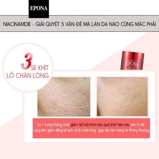 Kem Dưỡng Da epona - Chuẩn auth