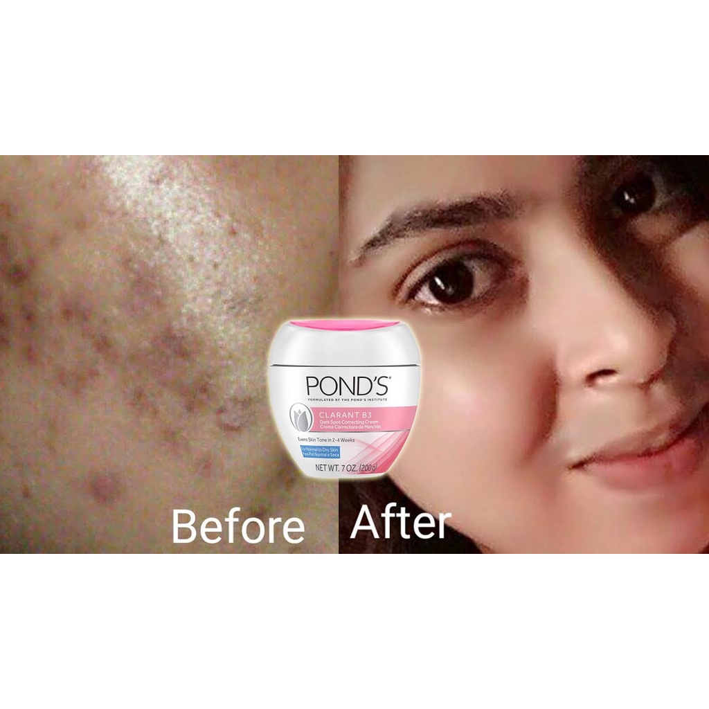Kem Dưỡng Trắng Sáng Da, Giảm Thâm Nám Da Pond's Clarant B3 Dark Spot Correcting Cream