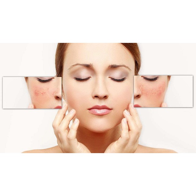 Viên uống Collagen Sakura Nhật Bản (Sakuramin White) Hộp 120 viên