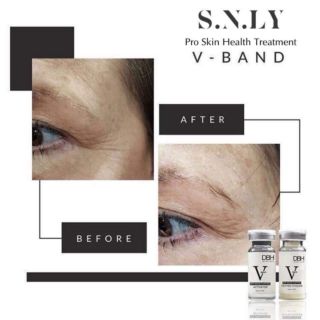 DBH V-band sét lẻ (bản mỹ)