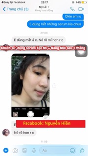 Serum Nâng Mũi Hàn