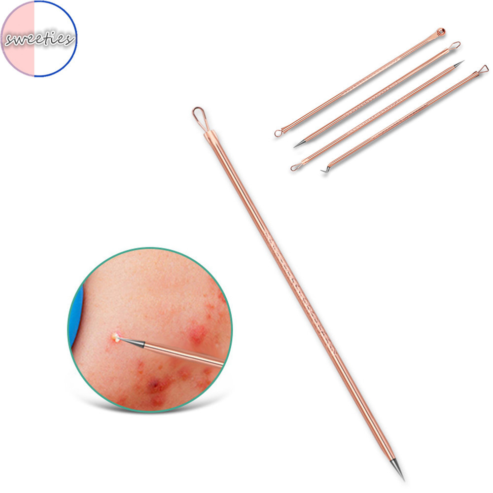 [Hàng mới về] Set 4 dụng cụ loại bỏ mụn đầu đen hiệu quả dành cho nam và nữ