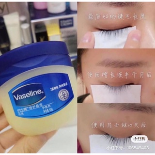 Vaseline đa năng và vaseline môi