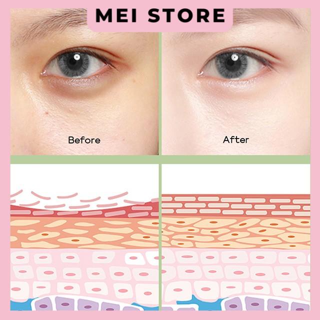 Kem Dưỡng Da Mắt Fenyi EYE CREAM Green Tea Chiết Xuất Trà Xanh Giảm Bọng Mắt 15g