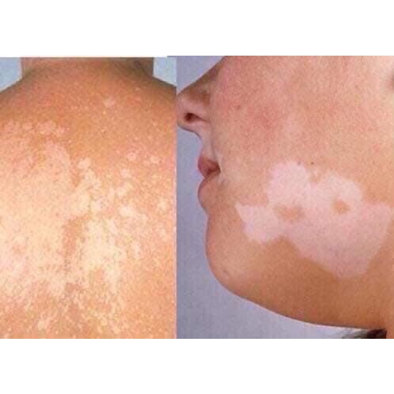 Lang ben hết sạch với Fango B