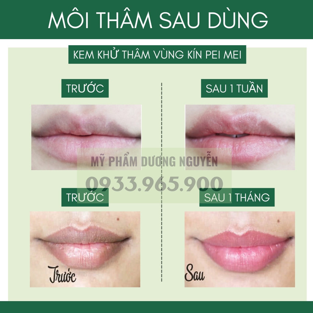 Chống Thâm Môi - Làm Hồng Môi - Nhũ Hoa - Vùng Kín Pei Mei Sexy Pink Bioaqua 30g