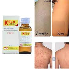 KELLA - SERUM LÀM NHỎ LỖ CHÂN LÔNG VÀ NAN LÔNG, LÔNG MỘC NGƯỢC - HÀNG THÁI LAN CHÍNH GỐC
