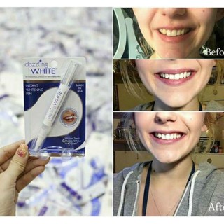 Bút Tẩy Trắng Răng DAZZING WHITE