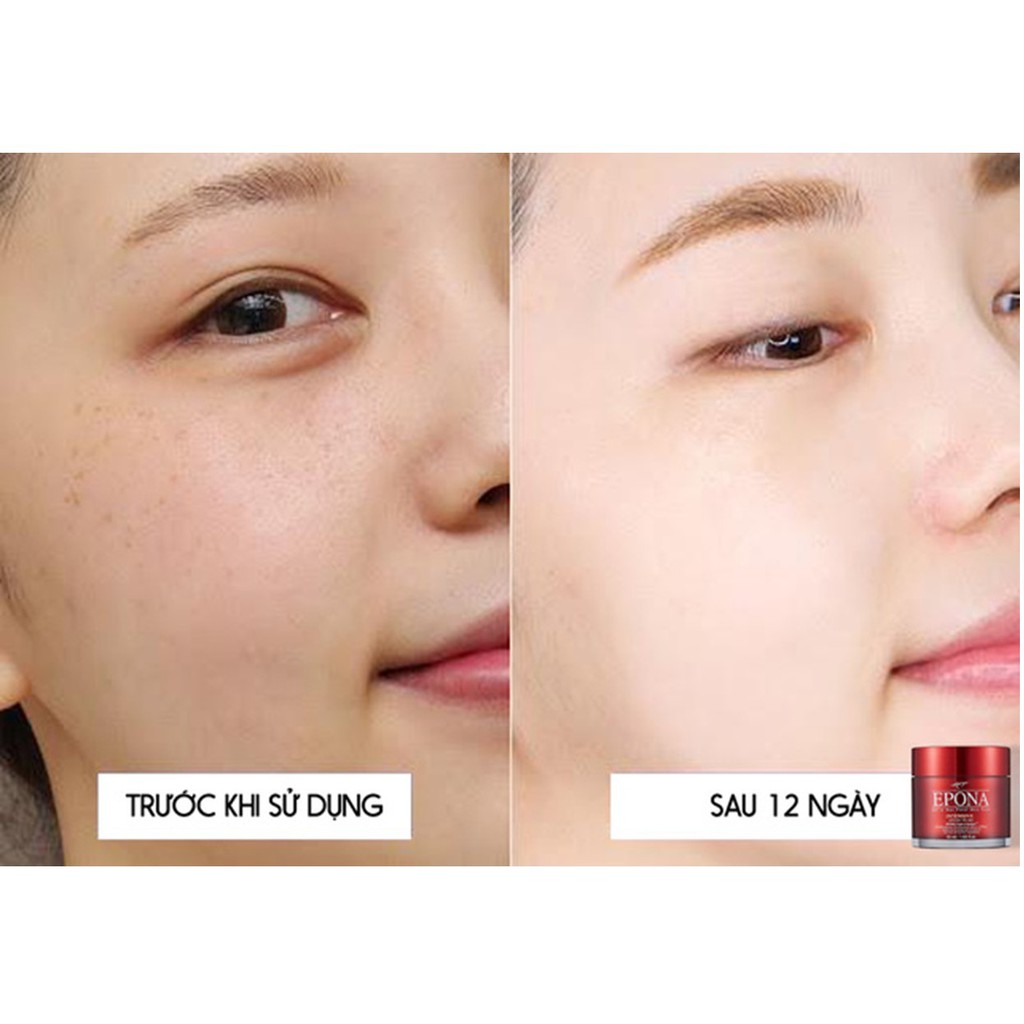 [Sample Size] Kem Dưỡng Da Sáng Da, Chống Lão Hóa Chiết Xuất Dầu Ngựa Epona All In One Total Skin Care Intensive 1ml