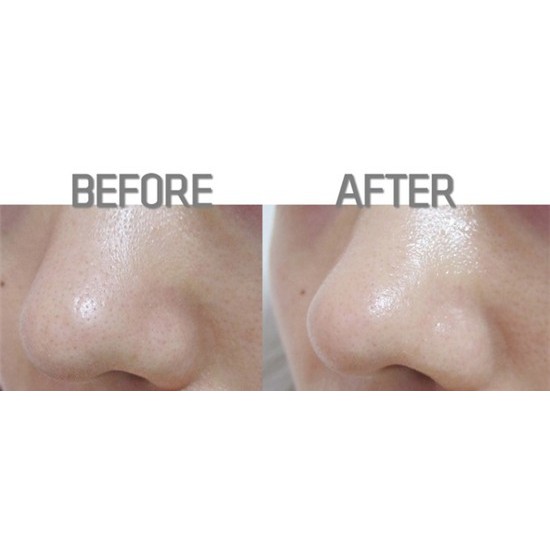 Hộp đẩy mụn đầu đen Goodbye Blackhead Ciracle 20 miếng