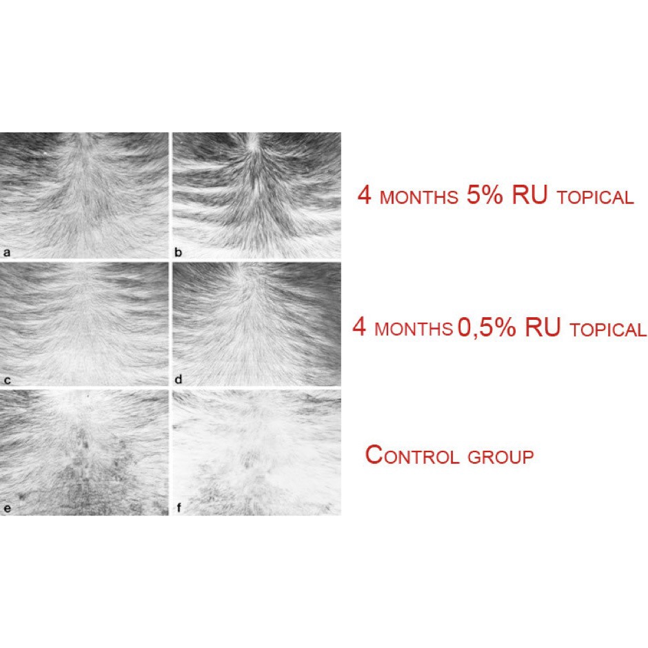 Bột RU58841 nguyên liệu mỹ phẩm tóc bôi kèm minoxidil, giúp tăng hiệu quả ngăn rụng hói