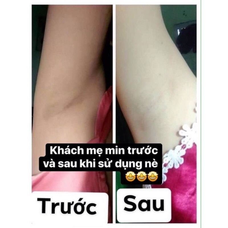 Kem Cô Bơ Thâm Nách Hôi Nách - Giảm Mùi Cực Kì Nhanh