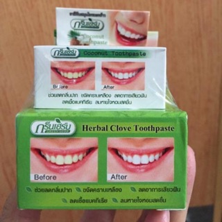 Kem tẩy trắng răng ( tặng hủ nhỏ)