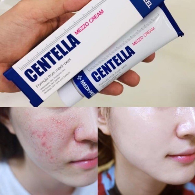 Kem rau má Medi-peel Centella Mezzo Hàn Quốc - Giảm mụn, mờ sẹo, tái tạo da