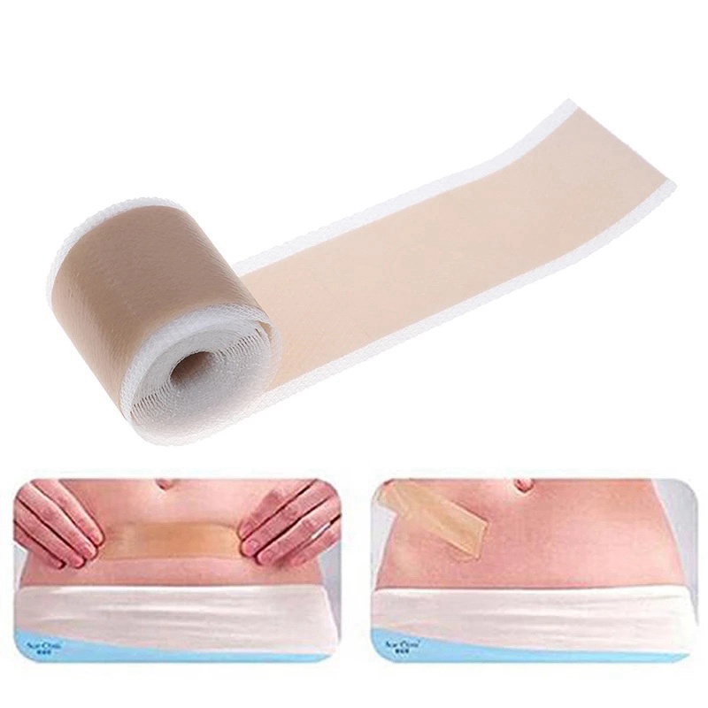 Set 3 Miếng Dán Silicone Hỗ Trợ Giảm Sẹo Mụn Hiệu Quả