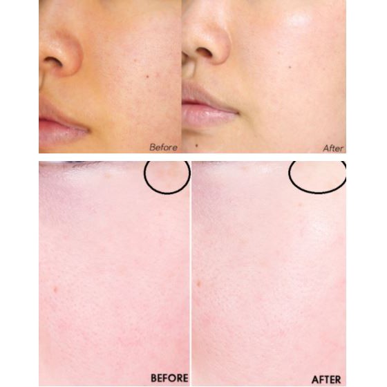 Kem Dưỡng Trắng Da, Mờ Nám Chiết Xuất Từ Đông Trùng Hạ Thảo DongSung Rannce Cream 70g | BigBuy360 - bigbuy360.vn