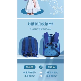 Balo UEK siêu nhẹ cho bé