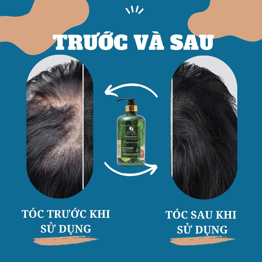 Dầu gội Bưởi ngăn rụng tóc kích thích mọc tóc chống nấm ngứa kiềm dầu sạch gàu Ailise Grapefruit Uk 850Ml - CHÍNH HÃNG