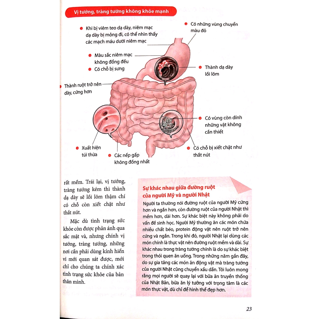 Sách - Nhân Tố Enzyme - Minh Họa (Tái Bản 2018)