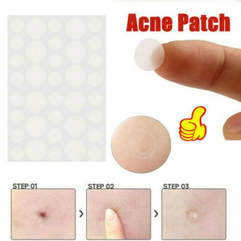 36/72pcs Invisible Skin Acne Patch Hydrocolloid Tag Skin Care Remover Sticker-RO