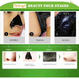 Gel lột mụn cám lột mụn đầu đen doberyl gd4