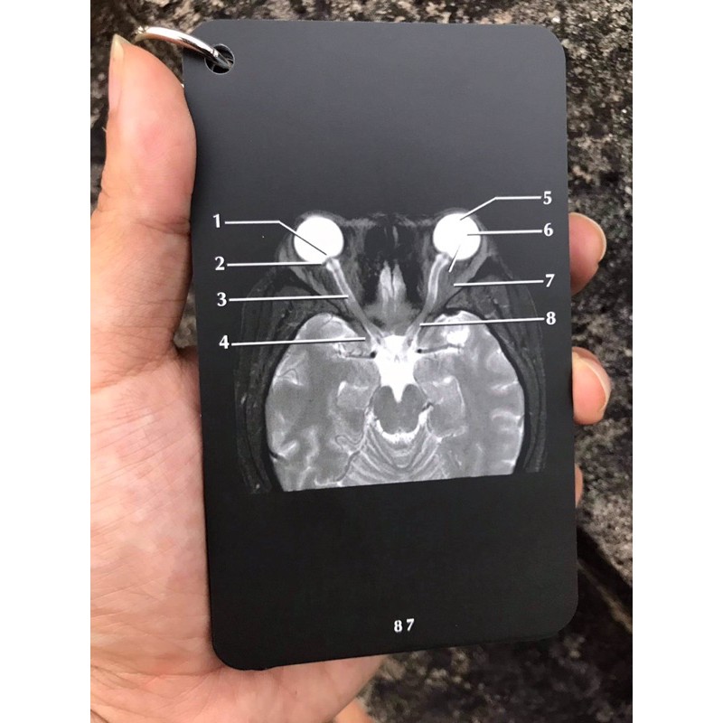 FA Xquang Head and Neck