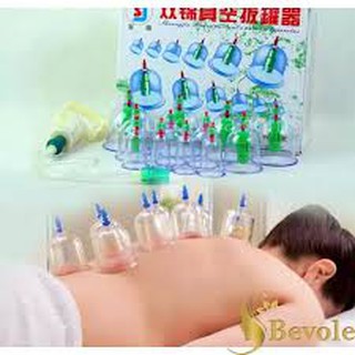 Bộ giác hơi 12 món không dùng lửa