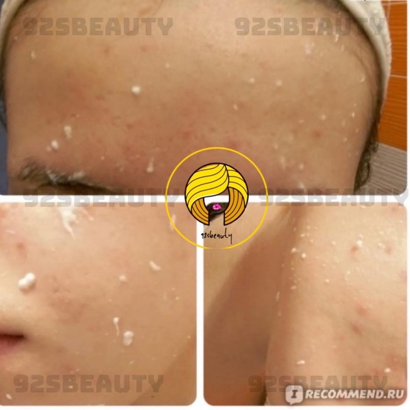 Tẩy da chết (tế bào chết) dạng kì Propeller 2in1 dành cho mọi loại da | BigBuy360 - bigbuy360.vn