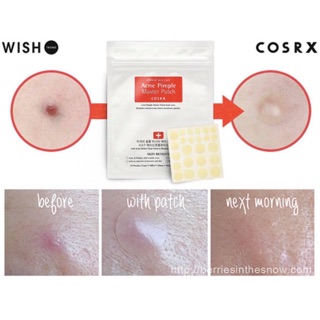 Miếng Dán Mụn Cosrx Acne Pimple Master Patch