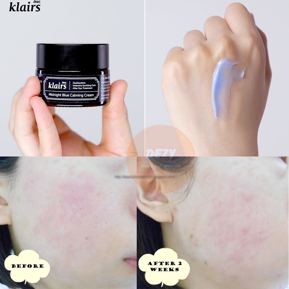 Kem Dưỡng Ẩm Klairs Midnight Cream Cho Da Dầu Da Mụn Và Da Nhạy Cảm Kem Đêm Dưỡng Ẩm Collagen Kháng Khuẩn Ngừa Mụn Dezy