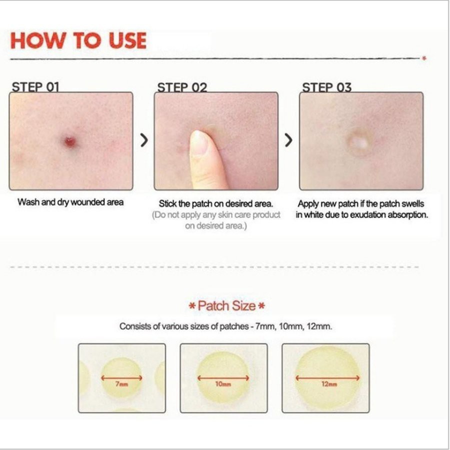 ☎Acne Patch Facial Beauty Acne Pimple Healing Patch Skin Treatment Stickers