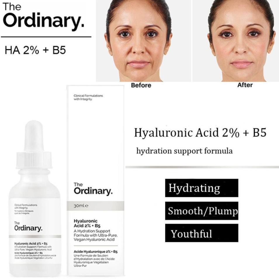 Serum The Ordinary Hyaluronic Acid 2% + B5 Cấp Ẩm Phục Hồi Da 30ml - PINK BEAUTY