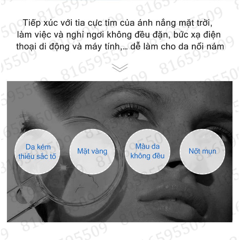 VENZEN Kem trị nám 50g Thích hợp cho các vết nám, tàn nhang, đốm thai kỳ, đốm nắng, đốm đen,  v.v.