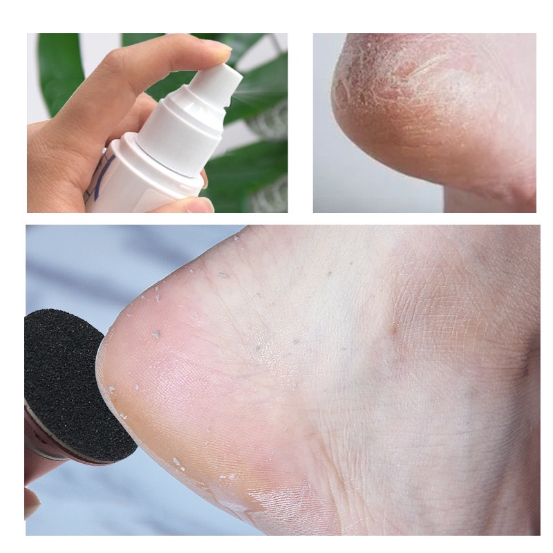 Chai xịt nước xịt mềm da chà gót eleven sử dụng cùng chà gót chân