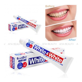 KEM ĐÁNH RĂNG SIÊU TRẮNG WHITE & WHITE