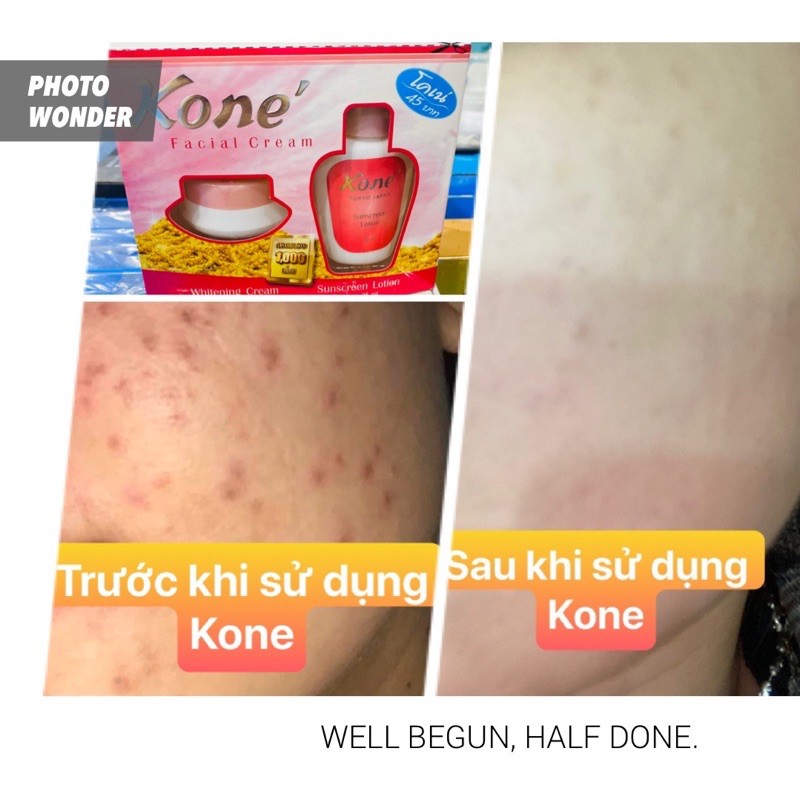 Kem Kone hàng Thái lan chính hãng ( mẫu mới hàng thật 100% ) | BigBuy360 - bigbuy360.vn
