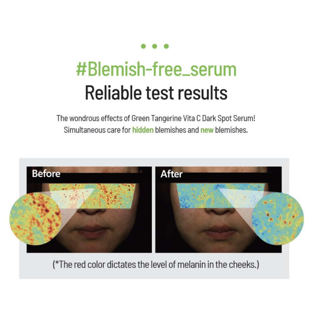 Tinh chất sáng da, mờ đốm nâu Goodal Green Tangerine Vita C Dark Spot Serum