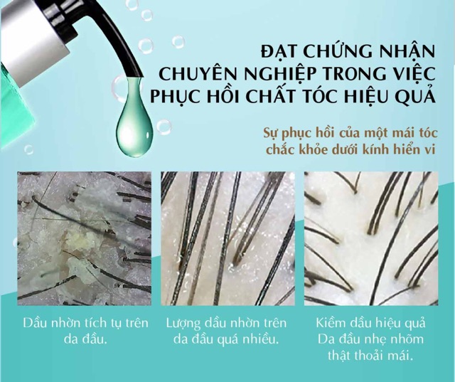 Dầu gội kiềm dầu 24h Parco - chiết xuất từ củ nghệ, dành cho tóc dễ bị bết. Giúp điều tiết và loại bỏ bớt dầu thừa | BigBuy360 - bigbuy360.vn