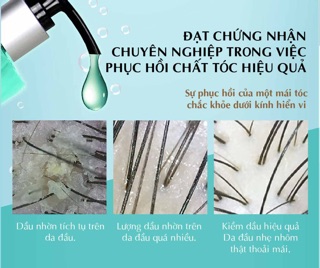 Dầu Gội Parco Oil Control Shampoo Dành Cho Tóc Dầu 400ml