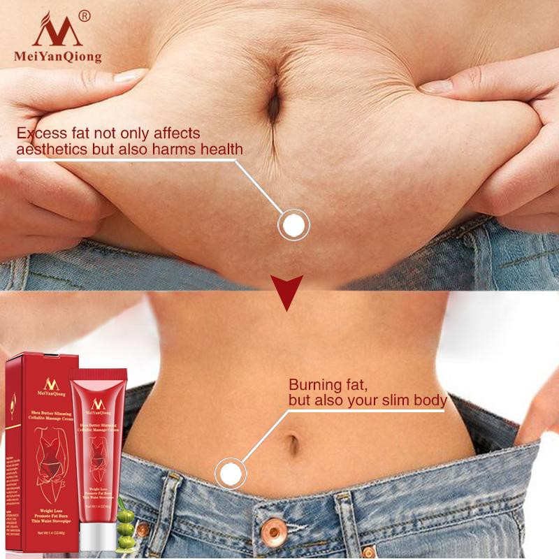 kem đốt mỡ Eo & bụng Kem Body Slimming Cream giảm béo Fat Burning Giảm Cân an toàn tự nhiên ProductsThin eo mỏng đùi nạc