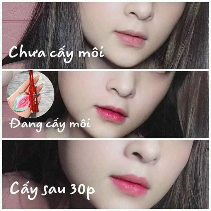 TINH CHẤT CẤY MÀU MÔI GIẢM THÂM MÔI BABIER LIPS VOLUME VAURA CHÍNH HÃNG - 7774