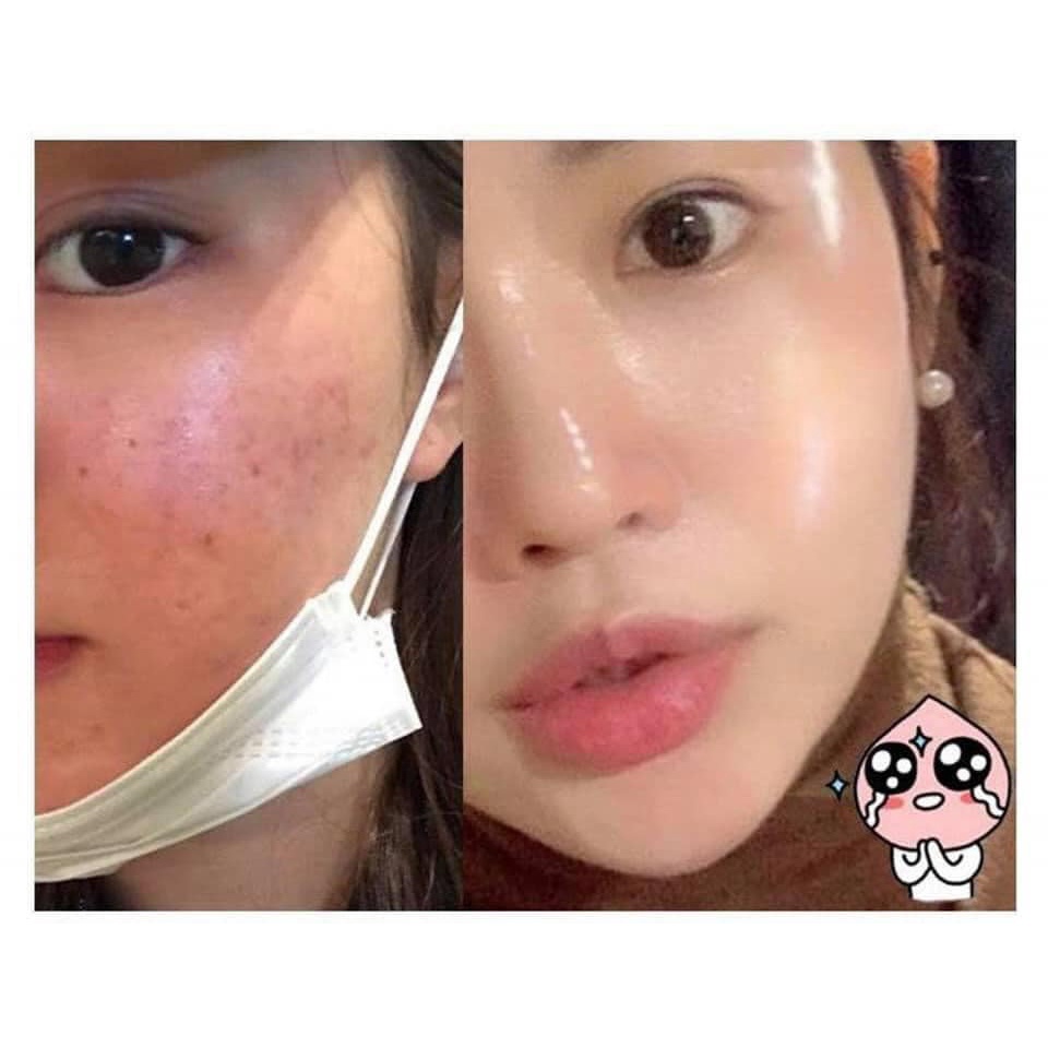 Tinh Chất Căng Bóng Làm Sáng Trẻ Hóa Medipeel Medi peel Peptide 9 Volume Bio Tox Biotox 100ml