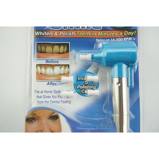 Máy đánh bóng răng, làm trắng Luma Smile