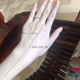 Thải độc mặt DETOX BLANC