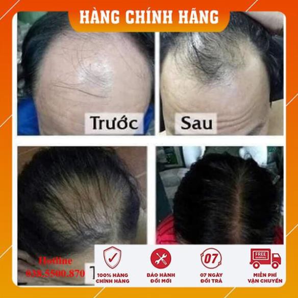 [ Hàng Chính Hãng] Dầu gội thảo dược dân gian Thanh Mộc Hương(Mẫu Mới Nhất)